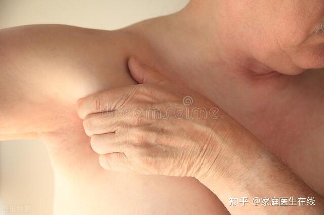 大腿根部息肉样赘生物_大腿根部赘生物_大腿根内侧长皮肤赘生物