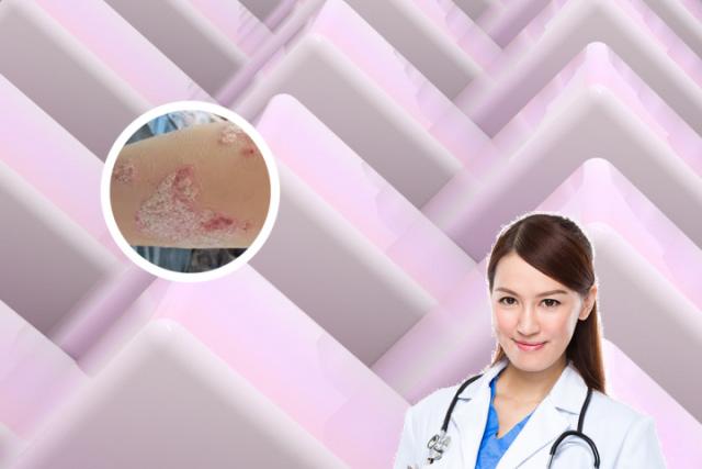 强直打什么生物制剂最好