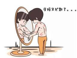 银屑病专病门诊