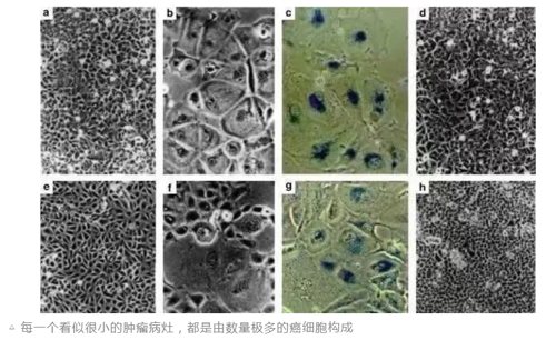 生物免疫治疗方法_免疫生物治疗方法包括_免疫生物治疗方法有哪些