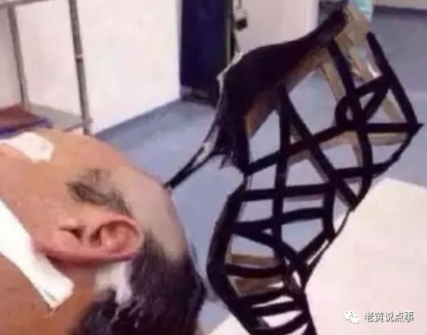 重大案件！奇闻：医院来了一个奇怪的男子，头上插着一只高跟鞋，原因笑了