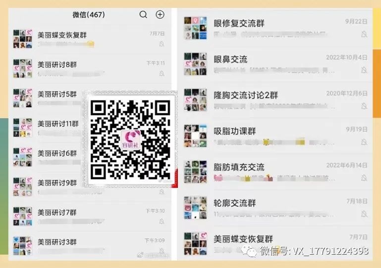 3d生物束带紧缩术多少钱？对比八爪鱼私密紧致价格及口碑选择哪个更好