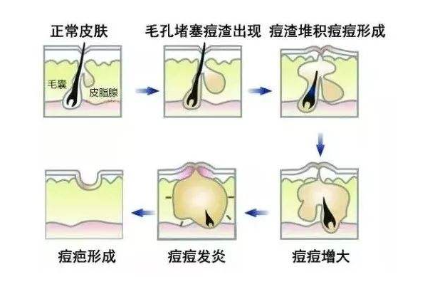 治疗牛皮病癣的生物制剂价格_牛皮鲜生物药剂_牛皮治疗生物制剂