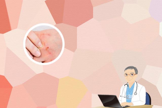 皮肤病什么情况下打生物制剂