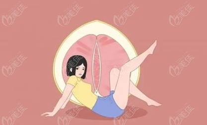 3d生物束带后真实感受是做完紧缩术真的变小了,收费36000+真不后悔