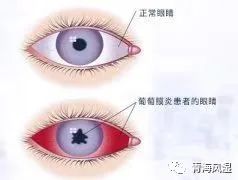 阿达木这个是生物制剂_生物制剂啊达木价格_生物制药阿达木