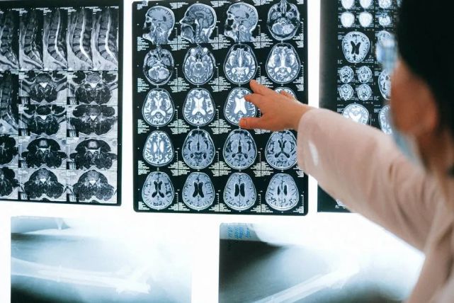 《柳叶刀·肿瘤学》：全球首次！科学家发现，神经干细胞装载溶瘤病毒治疗新诊断高级别胶质瘤安全可行，特定患者有较大获益丨临床大发现