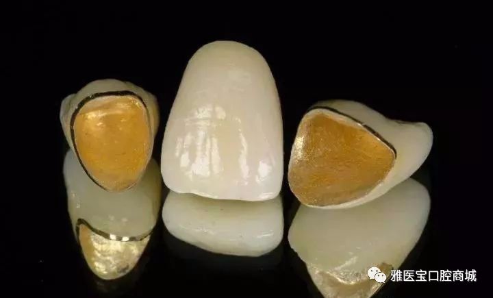 生物性烤瓷牙_生物烤瓷牙费用_生物烤瓷牙含金属吗
